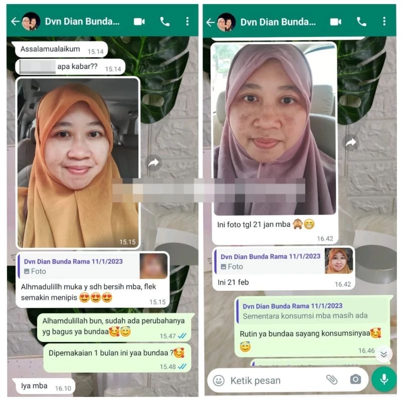 Testimony Kolagen DVN