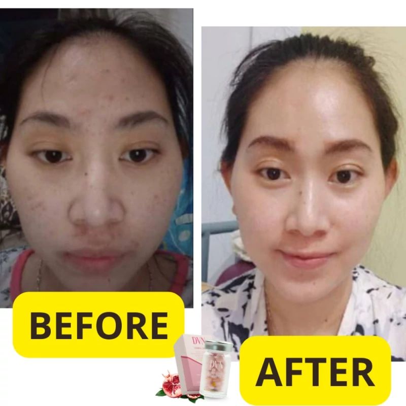 Testimony Kolagen DVN