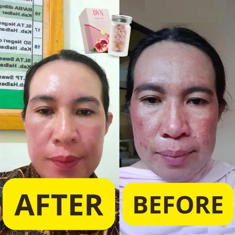 Testimony Kolagen DVN